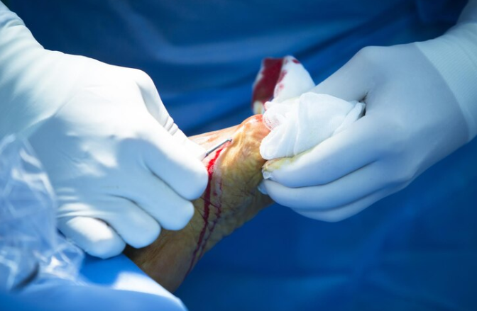 Guide PCL and ACL Tears: Treatment Options and Top Surgeons in India