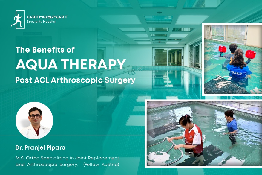 HEALING WATERS:  The Benefits of AQUA THERAPY Post ACL Arthroscopic Surgery