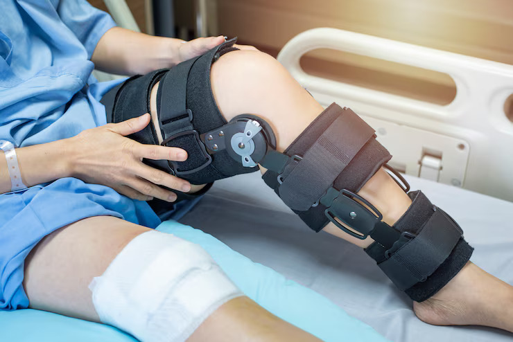 Expert Tips on Reducing Knee Replacement Surgery Costs in Ahmedabad